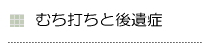 むち打ち（むちうち）と後遺障害（後遺症）